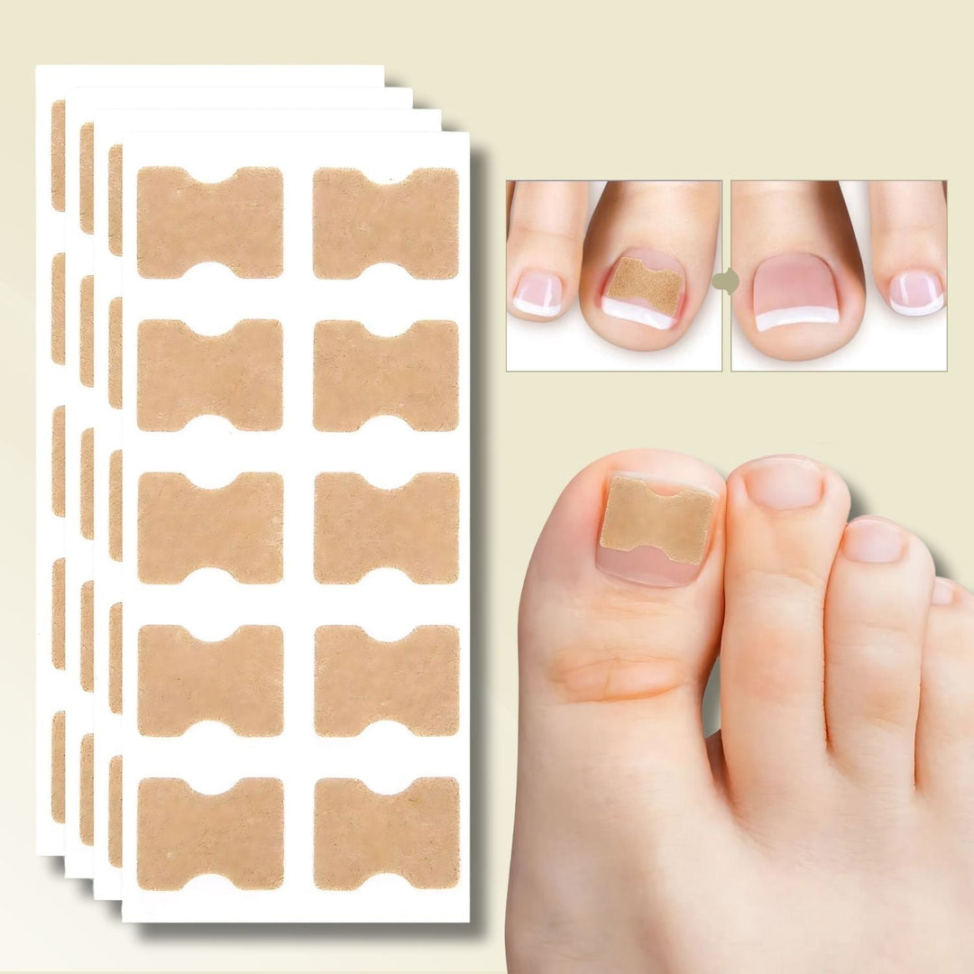Unisex nagelreparationsplåster för inåtväxta naglar, smärtlindrande nagelvård för effektiv fotvård. 10-pack.